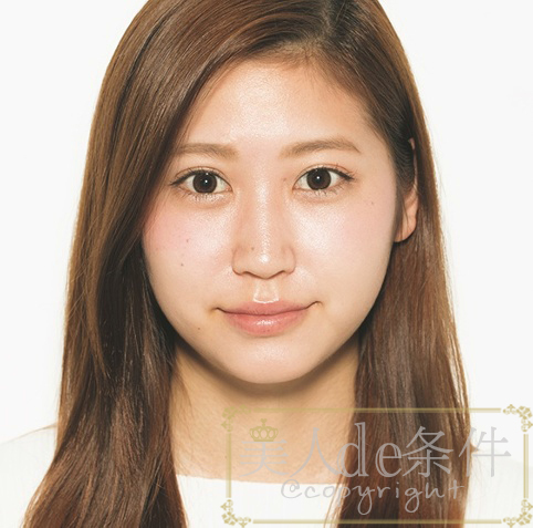 眉头太低打玻尿酸怎么能提上去,经常皱眉要不要打玻尿酸