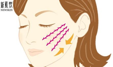pst面部提升和拉皮手术有什么区别,内窥镜面部提升手术有什么危害