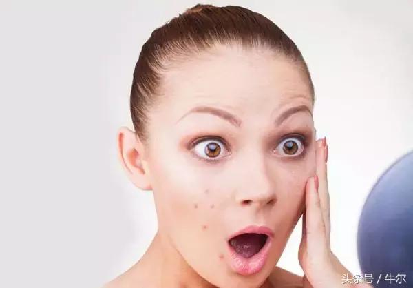 突然开始长痘该如何注意,40岁男人额头长痘什么原因引起