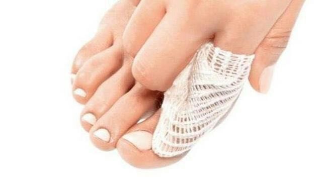 脚趾甲长到肉里很疼怎么止疼,脚趾甲长肉里一碰就痛咋办