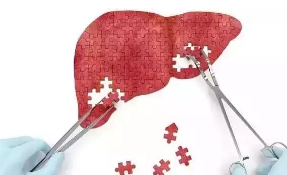 自身免疫性肝病产生原因,自身免疫系统肝病早期什么症状