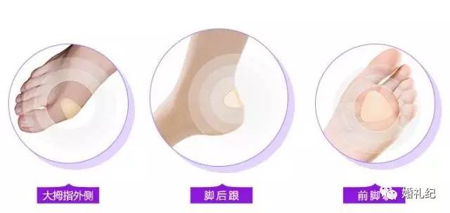 痛！有新娘把婚鞋买成了X鞋！