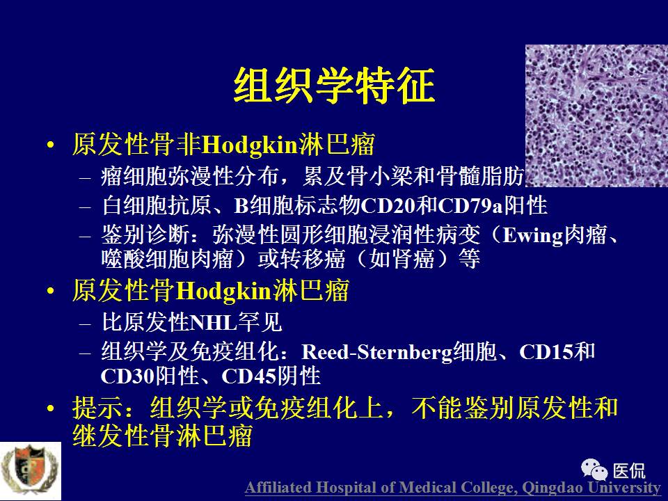徐文坚老师精讲：原发性骨淋巴瘤影像学诊断医学影像精品PPT