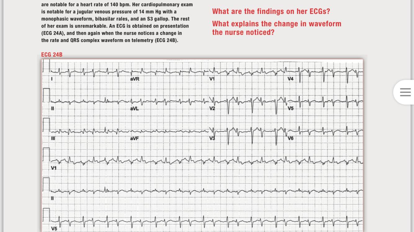 「读心有术」168期：房扑也能文氏传导，你听说过吗？