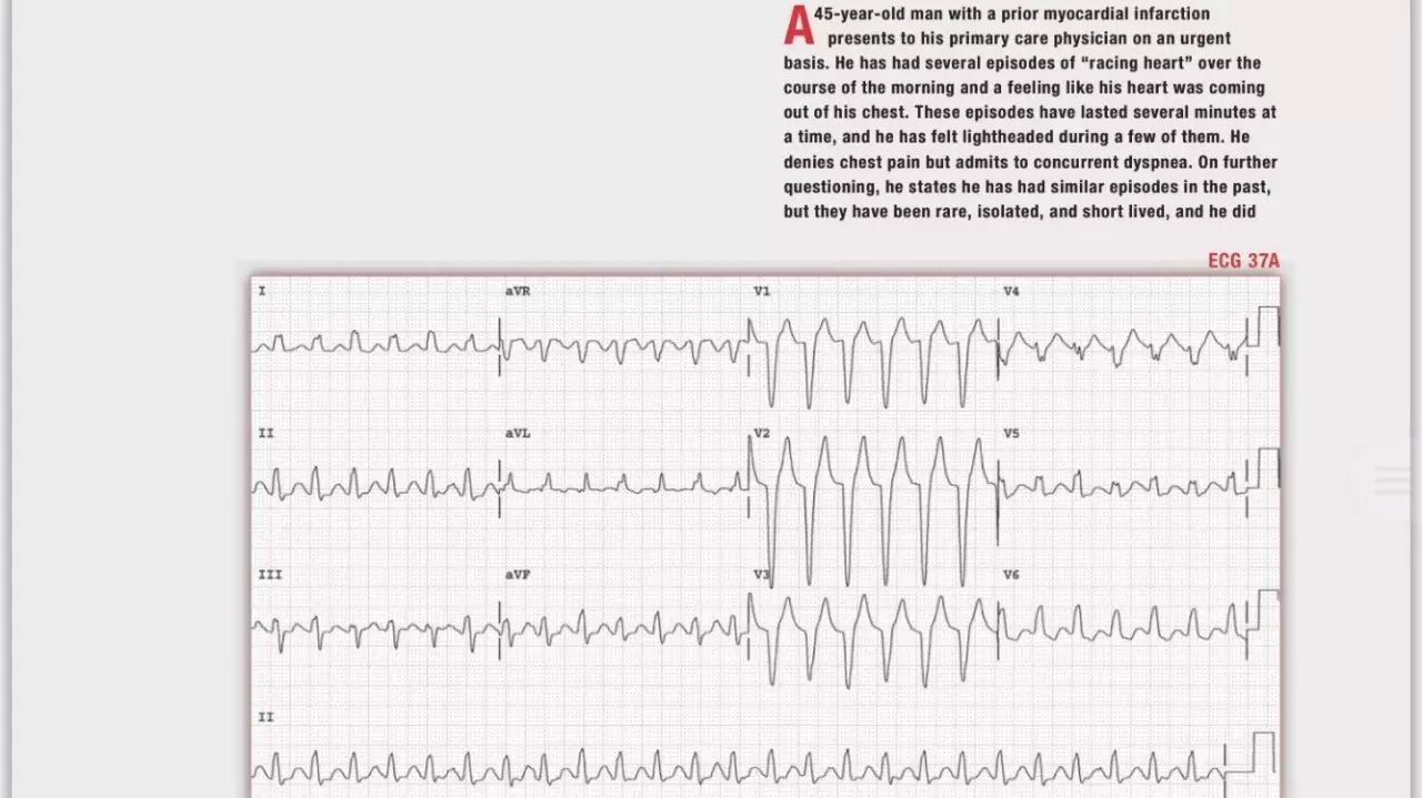 读心有术100期,读心有术171