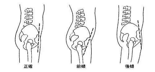 开胯为何痛不欲生？其实原因并不在胯上