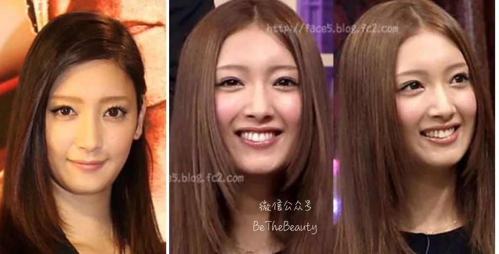 鼻翼宽鼻头大怎么办,塌鼻子鼻翼宽妆容