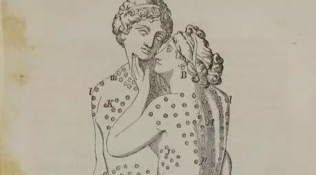 19世纪的针刺万能疗法是这样的