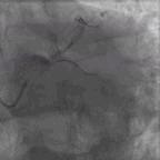 典型病例及处理方法,典型病例分析及治疗方法