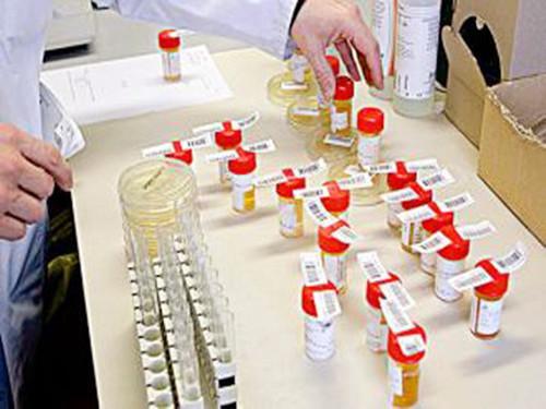 尿检指标科学解读！