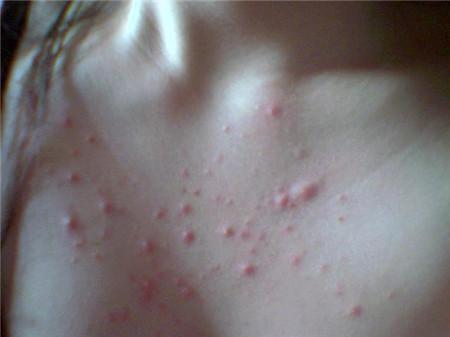 女性湿气太重的人有哪些症状,女人身体的湿气太重有什么症状