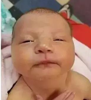 亲吻有毒，爱宝宝，就不要给他“黑暗之吻”