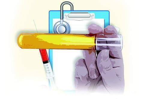 怀孕尿检什么指标,尿检指标科学解读