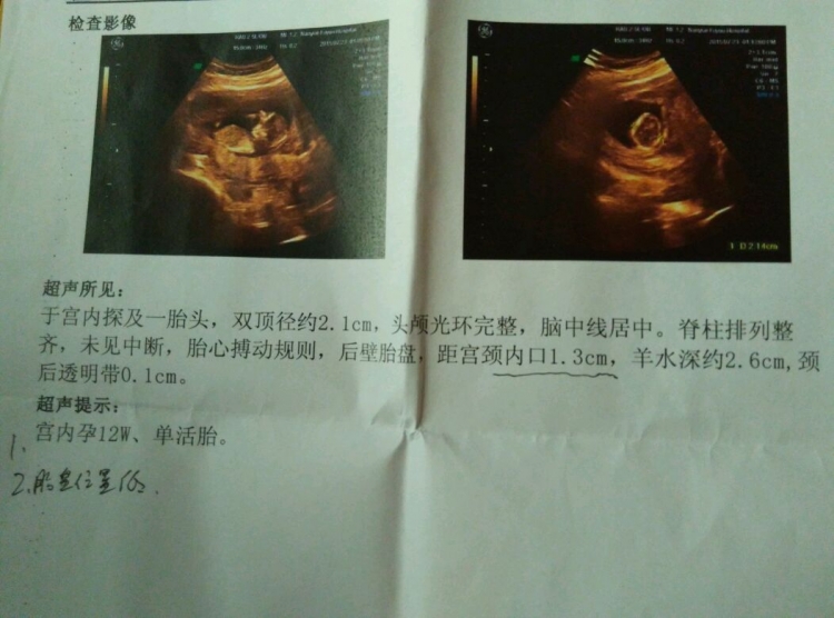 孕妇胎盘前置咋办,孕妈胎盘前置可以顺产的吗