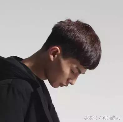 有点秃剪什么刘海,有点秃鬓角怎么办