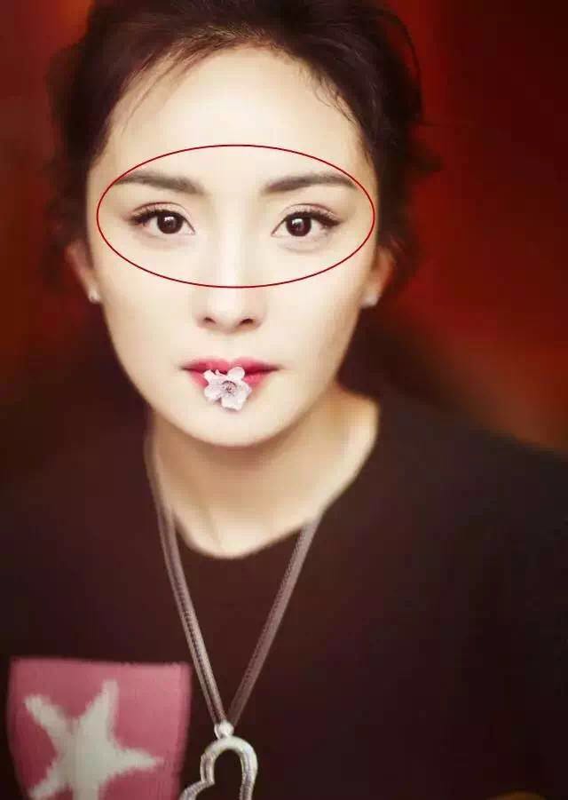 杨幂眼皮松弛怎么补救的,杨幂眼睛肿了怎么回事