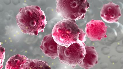 蛋白潜血总不降怎么回事,肾病有潜血是什么原因