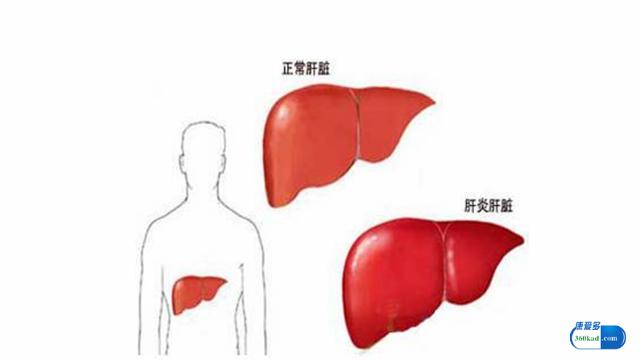 肝炎出现转氨酶升高用什么中草药,肝炎引起的转氨酶高怎么办