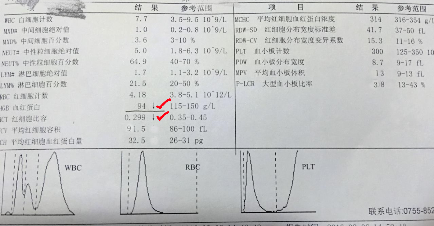 血常规报告单数据可以看出贫血,地中海贫血的血常规报告单怎么看