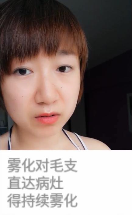 病毒性气管支气管炎症状,急性毛细支气管炎的最佳治疗