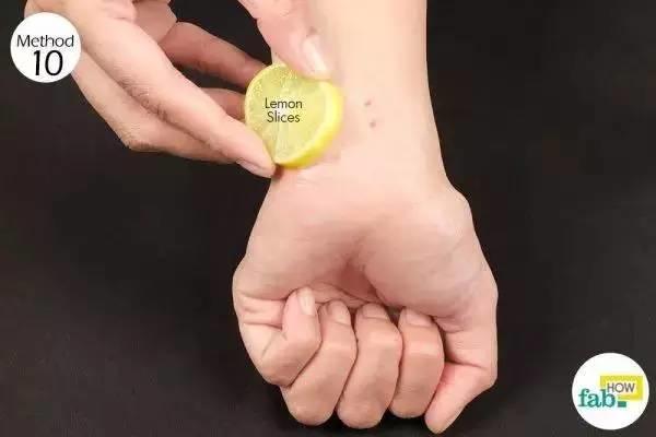 蚊子咬了最有效的止痒方法,蚊子咬了有什么止痒方法