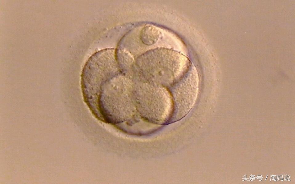 胎儿发育40周全过程注意事项,赞宝宝训练抬头的句子