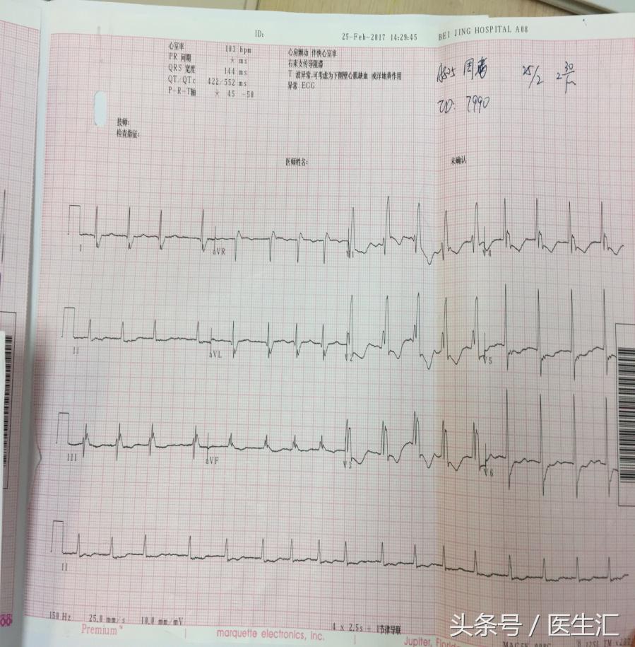 80岁老人突然脑梗塞,80岁老人脑梗塞怎么治