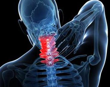 颈椎病脖子僵硬后背疼吃啥药好,颈椎病胳膊肩膀后背脖子困怎么办