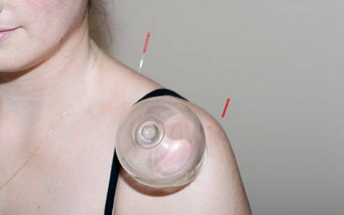 脸上有斑拔罐拔哪个位置图,拔罐的好处和坏处视频