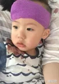 孩子摔跤到膝盖出血该怎么处理,四岁孩子摔跤缝了22针