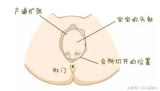 产后小课堂：顺产和剖宫产的伤口护理知识大全，让你轻松坐好月子