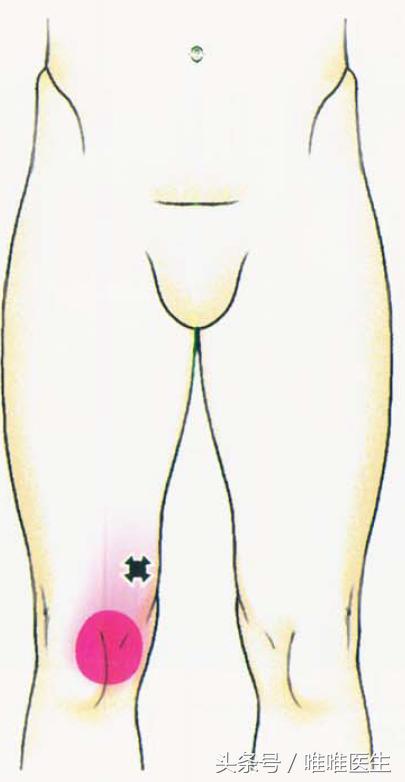 绝对干货膝盖损伤知识一网打尽,膝关节疼痛知识科普