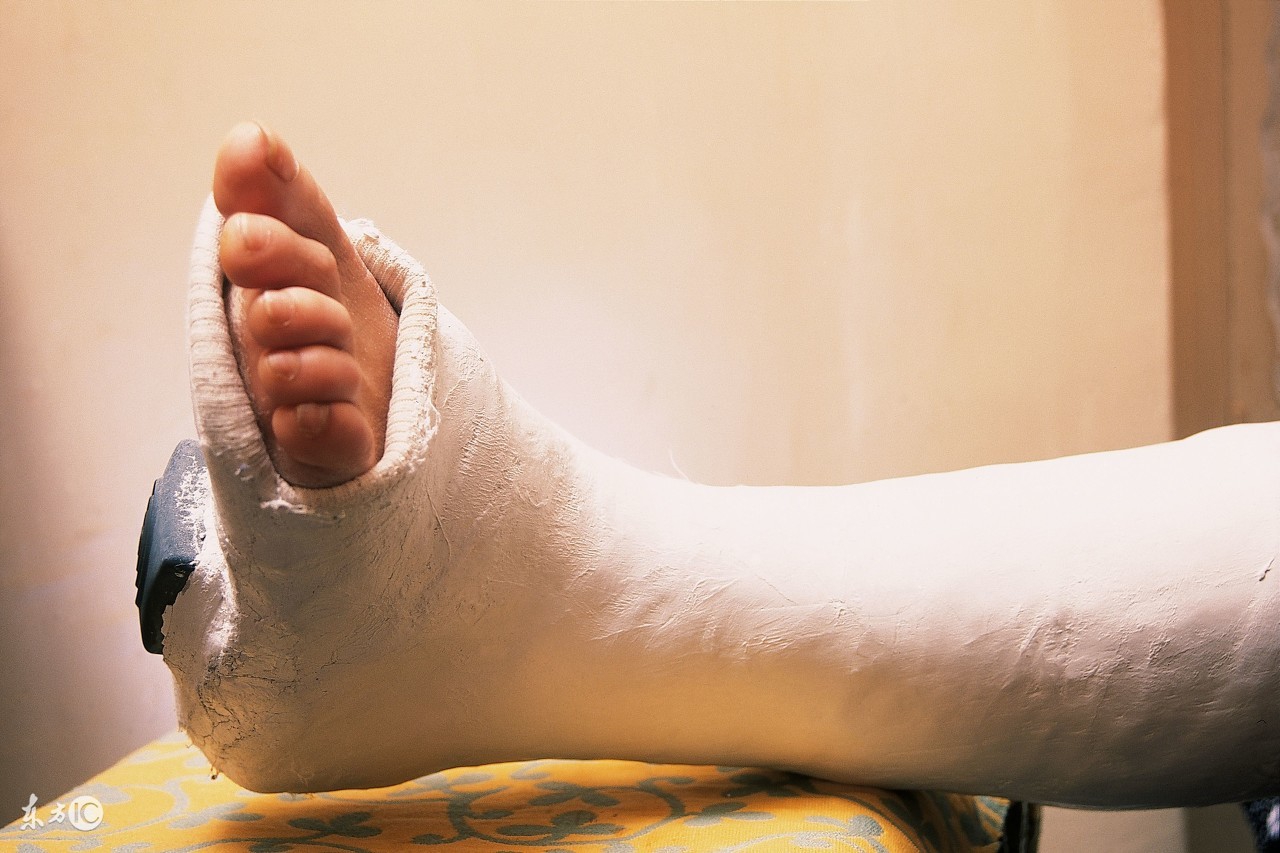 打球出现了骨折怎么处理,球场骨折