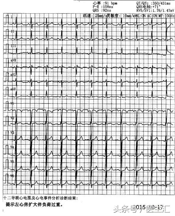 25岁能得心脏病吗,20岁就得了心衰