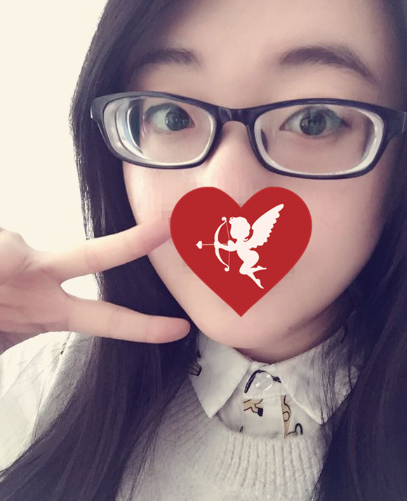 近视眼手术7年后的亲身经历,近视眼手术20年后的亲身经历