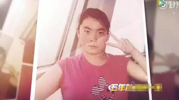 长得丑整容蜕变,长得特别丑整容成功