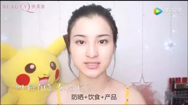 脸上的痘痘痘印怎么最有效的去除,痘痘红痘印黑痘印