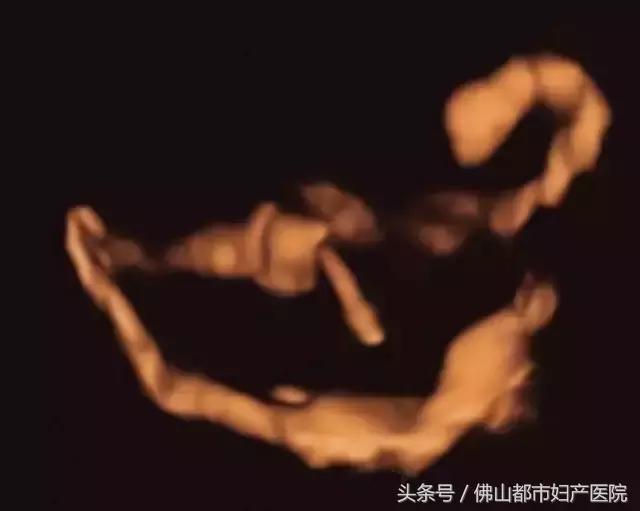 输卵管四维超声造影，不孕患者的福音