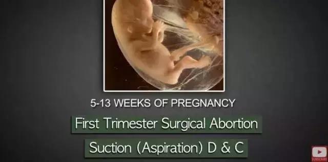 LAN《性、安全、录像带》