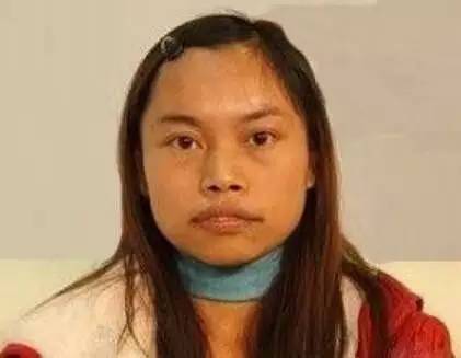 专家讲解明星微整形 (明星教你微整形)