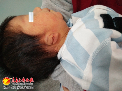 小乐乐不再“与众不同”*疆新**首例先天耳畸形无创矫正术成功