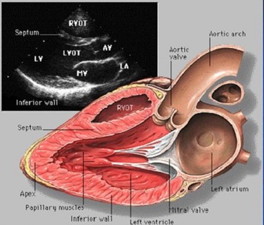心脏抗凝期出血怎么办,心脏血肿手术