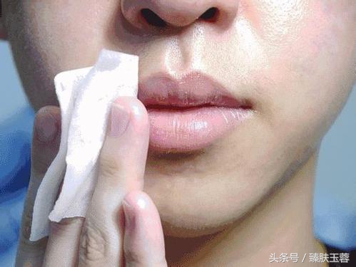 激素性皮炎用什么护肤品修复,激素皮肤过敏怎么治疗