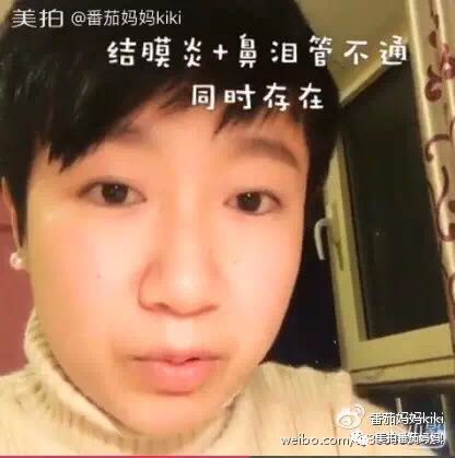 宝宝眼睛都是眼屎粘住了,宝宝眼睛被黄色眼屎糊住