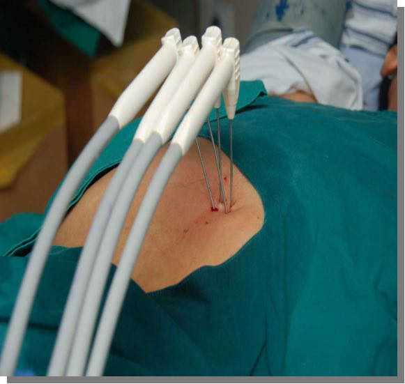 深圳治疗癌症新技术,深圳肿瘤医院有免疫疗法吗