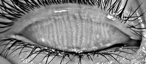 厦门眼健康中心,厦门眼科中心科普馆