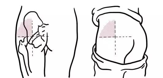 为什么医生打针要加葡萄糖,为什么医生打针要打在血管里