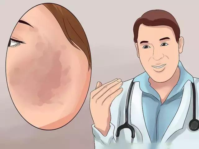 激光美容后脸上黑点多久能消除,消除脸上黑点吃什么药