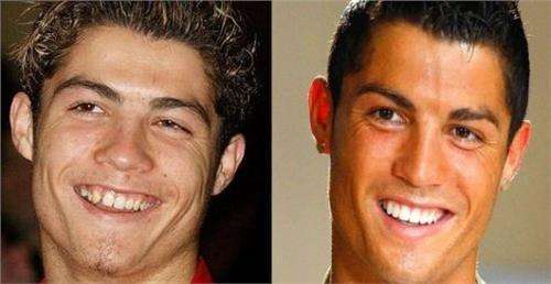 牙齿牙缝太宽会漏财吗,牙缝宽漏财是真的吗