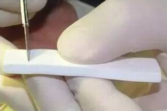 了解下丰胸的含义是什么,隆下巴科普